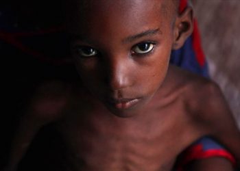 ‘Dünyada her gün 25 bin kişi açlıktan ölüyor’