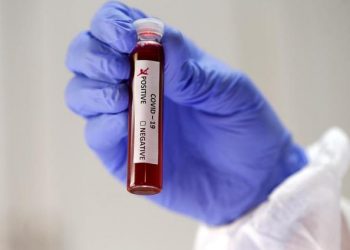 Türk Veteriner Hekimleri Birliği: Elimizdeki solunum ve yoğun bakım cihazlarını koronavirüs tedavisine sunmaya hazırız